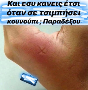 Κατεβαίνει το χέρι δημοτικός σύμβουλος και του ρίχνετε ψήφο λογικά..